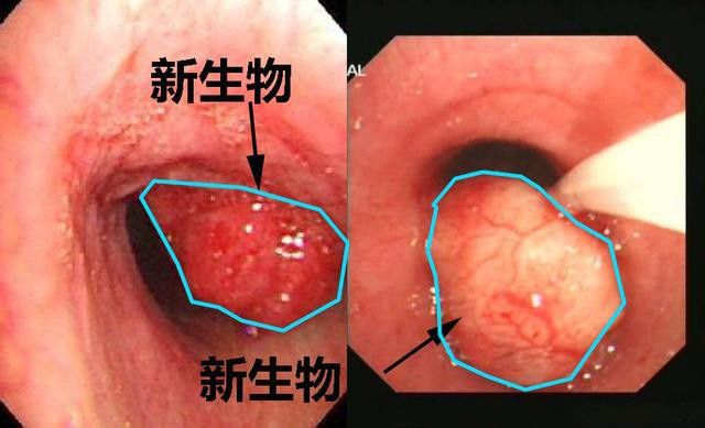 西门子地址_哈尔滨狗不理包子地址_imtoken子地址